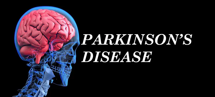 Clinical Study – Accuracy Of Markerless 3D Motion Capture Evaluation In Parkinson’s Disease